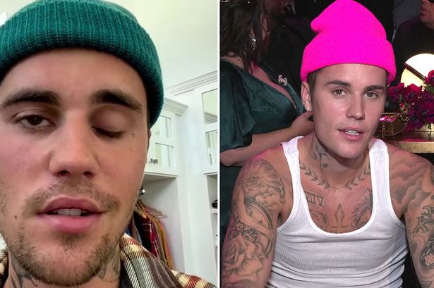 Video: Justin Bieber Partially Paralysed, Says 'I Can't Smile On This Side Of My Face