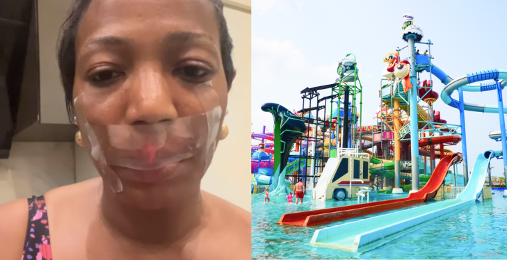 WARNING!: Giwa Gardens Waterpark Not Safe, Injured Guest Warns Nigerians